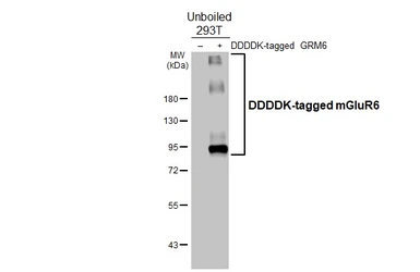 Anti-mGluR6 antibody [HL4518] used in Western Blot (WB). GTX644088