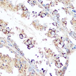 Anti-Diablo antibody used in IHC (Paraffin sections) (IHC-P). GTX64409