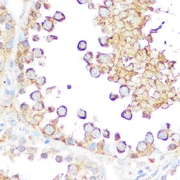 Anti-Diablo antibody used in IHC (Paraffin sections) (IHC-P). GTX64409