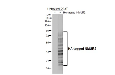 Anti-NMUR2 antibody [HL4522] used in Western Blot (WB). GTX644092