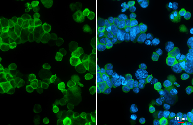 Anti-CD9 antibody [HL4524] used in Immunocytochemistry/ Immunofluorescence (ICC/IF). GTX644094
