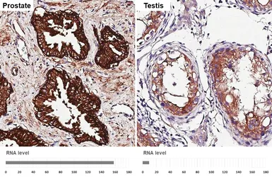 Anti-CD9 antibody [HL4525] used in IHC (Paraffin sections) (IHC-P). GTX644095