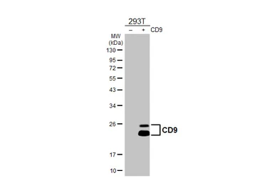 Anti-CD9 antibody [HL4525] used in Western Blot (WB). GTX644095