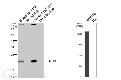 Anti-CD9 antibody [HL4525] used in Western Blot (WB). GTX644095