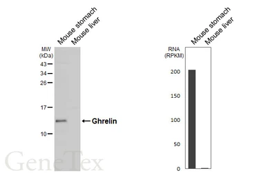 Anti-Ghrelin antibody [HL4526] used in Western Blot (WB). GTX644096