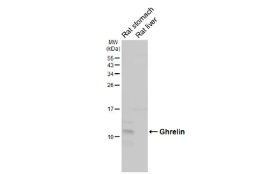 Anti-Ghrelin antibody [HL4526] used in Western Blot (WB). GTX644096