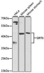 Anti-SIRT6 antibody used in Western Blot (WB). GTX64410