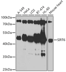 Anti-SIRT6 antibody used in Western Blot (WB). GTX64410