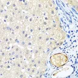 Anti-LRP5 antibody used in IHC (Paraffin sections) (IHC-P). GTX64412