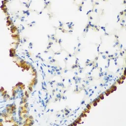 Anti-LRP5 antibody used in IHC (Paraffin sections) (IHC-P). GTX64412