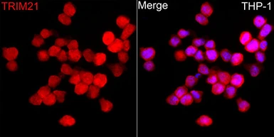 Anti-SSA1 antibody used in Immunocytochemistry/ Immunofluorescence (ICC/IF). GTX64414
