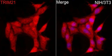 Anti-SSA1 antibody used in Immunocytochemistry/ Immunofluorescence (ICC/IF). GTX64414