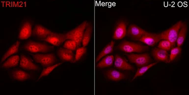 Anti-SSA1 antibody used in Immunocytochemistry/ Immunofluorescence (ICC/IF). GTX64414