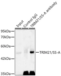 Anti-SSA1 antibody used in Immunoprecipitation (IP). GTX64414