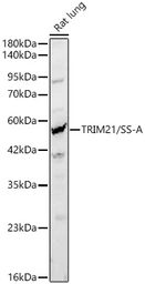 Anti-SSA1 antibody used in Western Blot (WB). GTX64414