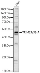 Anti-SSA1 antibody used in Western Blot (WB). GTX64414
