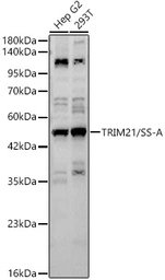Anti-SSA1 antibody used in Western Blot (WB). GTX64414