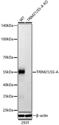 Anti-SSA1 antibody used in Western Blot (WB). GTX64414