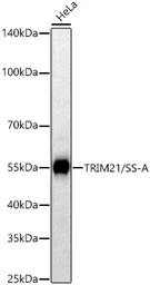 Anti-SSA1 antibody used in Western Blot (WB). GTX64414