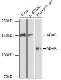 Anti-ADAR1 antibody used in Western Blot (WB). GTX64415