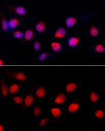 Anti-ADAR1 antibody used in Immunocytochemistry/ Immunofluorescence (ICC/IF). GTX64415