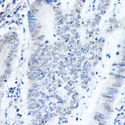Anti-ADAR1 antibody used in IHC (Paraffin sections) (IHC-P). GTX64415