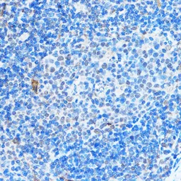 Anti-ADAR1 antibody used in IHC (Paraffin sections) (IHC-P). GTX64415