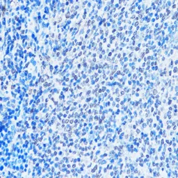 Anti-ADAR1 antibody used in IHC (Paraffin sections) (IHC-P). GTX64415