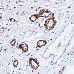 Anti-MLCK antibody used in IHC (Paraffin sections) (IHC-P). GTX64416