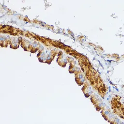 Anti-MLCK antibody used in IHC (Paraffin sections) (IHC-P). GTX64416