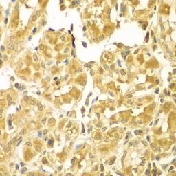 Anti-SESN2 antibody used in IHC (Paraffin sections) (IHC-P). GTX64418