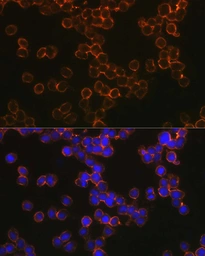 Anti-DC-SIGN antibody used in Immunocytochemistry/ Immunofluorescence (ICC/IF). GTX64419