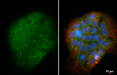 Anti-Apolipoprotein D antibody [HL4532] used in Immunocytochemistry/ Immunofluorescence (ICC/IF). GTX644200