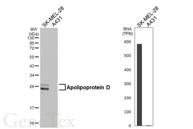 Anti-Apolipoprotein D antibody [HL4532] used in Western Blot (WB). GTX644200