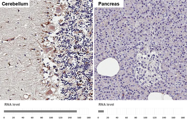 Anti-Apolipoprotein D antibody [HL4532] used in IHC (Paraffin sections) (IHC-P). GTX644200