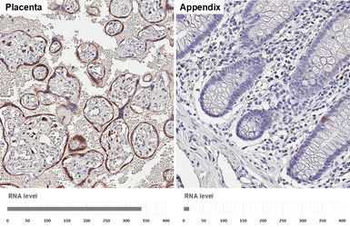 Anti-Apolipoprotein D antibody [HL4532] used in IHC (Paraffin sections) (IHC-P). GTX644200
