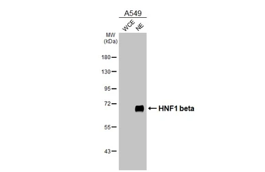 Anti-HNF1 beta antibody [HL4538] used in Western Blot (WB). GTX644206