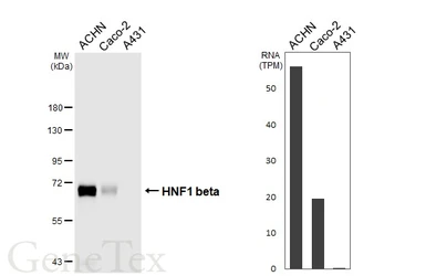 Anti-HNF1 beta antibody [HL4538] used in Western Blot (WB). GTX644206