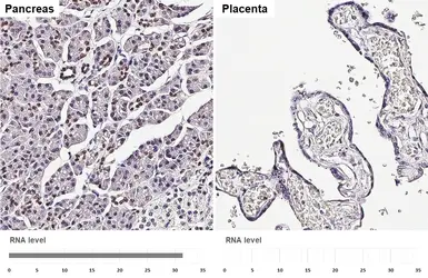 Anti-HNF1 beta antibody [HL4538] used in IHC (Paraffin sections) (IHC-P). GTX644206