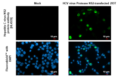 Anti-Hepatitis C virus NS2 protein antibody [HL4539] used in Immunocytochemistry/ Immunofluorescence (ICC/IF). GTX644207