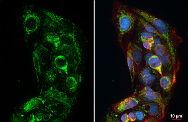 Anti-IRE1 alpha (phospho Ser724) antibody [HL4542] used in Immunocytochemistry/ Immunofluorescence (ICC/IF). GTX644210