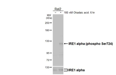 Anti-IRE1 alpha (phospho Ser724) antibody [HL4542] used in Western Blot (WB). GTX644210