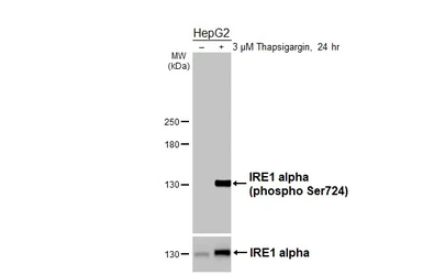 Anti-IRE1 alpha (phospho Ser724) antibody [HL4542] used in Western Blot (WB). GTX644210
