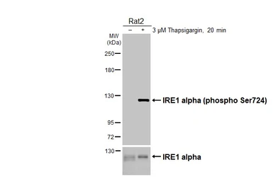 Anti-IRE1 alpha (phospho Ser724) antibody [HL4542] used in Western Blot (WB). GTX644210