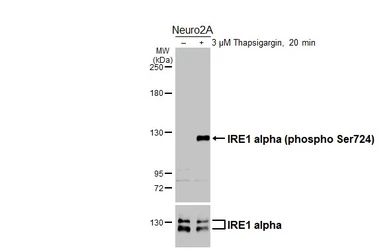 Anti-IRE1 alpha (phospho Ser724) antibody [HL4542] used in Western Blot (WB). GTX644210