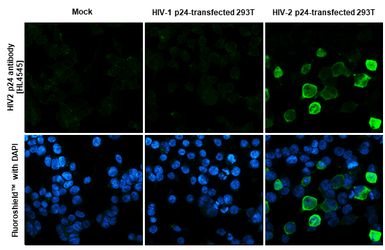 Anti-HIV2 p24 antibody [HL4545] used in Immunocytochemistry/ Immunofluorescence (ICC/IF). GTX644213