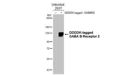 Anti-GABA B Receptor 2 antibody [HL4551] used in Western Blot (WB). GTX644219