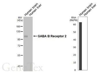Anti-GABA B Receptor 2 antibody [HL4551] used in Western Blot (WB). GTX644219