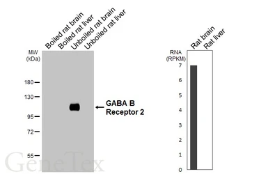 Anti-GABA B Receptor 2 antibody [HL4551] used in Western Blot (WB). GTX644219