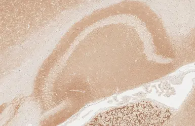 Anti-GABA B Receptor 2 antibody [HL4551] used in IHC (Paraffin sections) (IHC-P). GTX644219